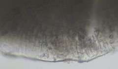 Mesophyllum lichenoides