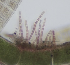 Acrochaetium cytophagum
