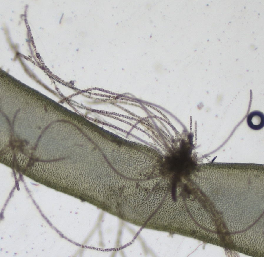 Erythrotrichia