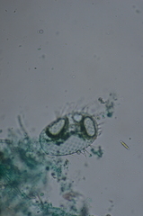 Euglypha