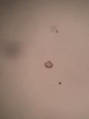 Protoperidinium