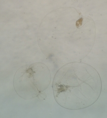 Noctiluca scintillans