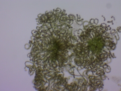 Dolichospermum lemmermannii