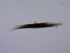 Aphanizomenon flosaquae