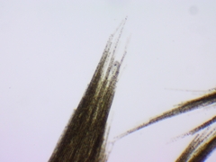 Aphanizomenon flosaquae