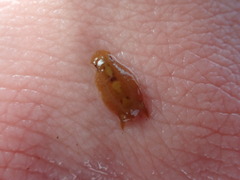 Amphoroidea media