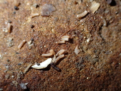 Caecum