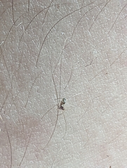 Araneae