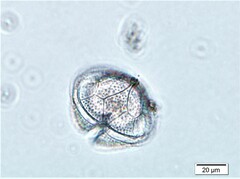 Protoperidinium