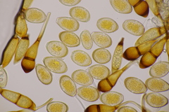 Puccinia graminis