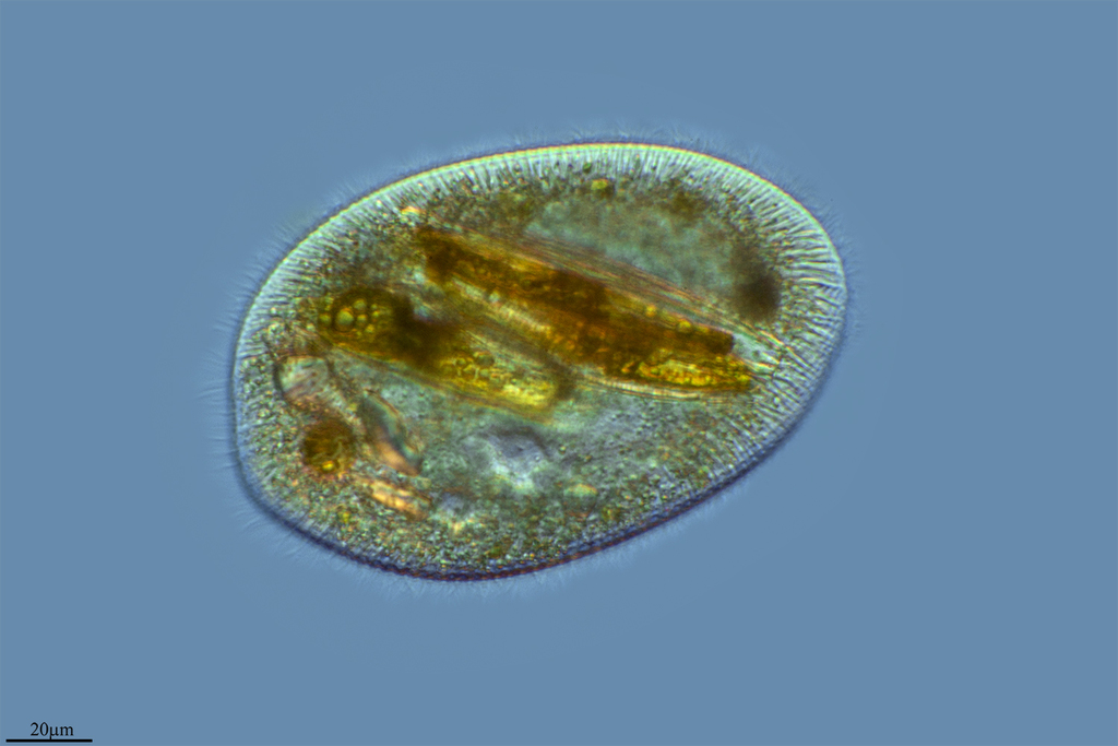 Pinnularia acuminata