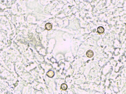Crepidotus applanatus (Photo 3 of 5)