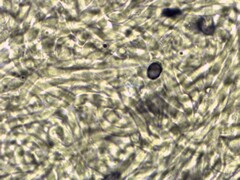 Leucopaxillus tricolor