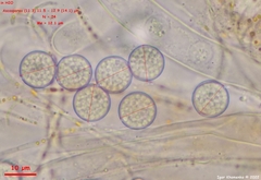 Pulvinula laeterubra