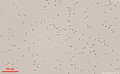 Trichoderma flavipes