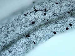 Stemonitopsis hyperopta