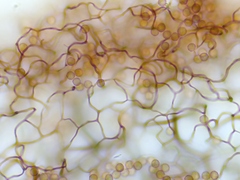 Stemonitopsis hyperopta