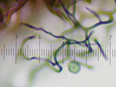 Stemonitopsis hyperopta