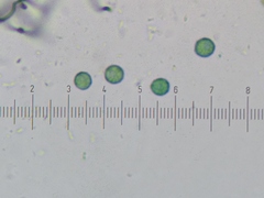 Stemonitopsis hyperopta