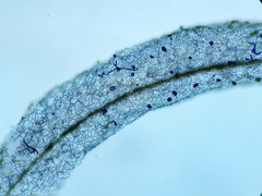 Stemonitopsis hyperopta