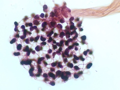 Cribraria microcarpa