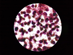 Cribraria microcarpa