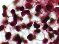 Cribraria microcarpa