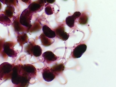 Cribraria microcarpa