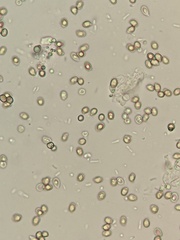 Volvariella nigrodisca