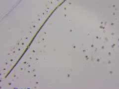 Dolichospermum planctonicum