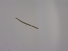 Dolichospermum planctonicum