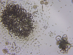 Dolichospermum lemmermannii