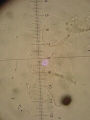 Narcissea patouillardii