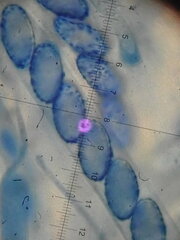 Scutellinia hirta