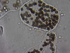 Microcystis