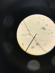 Anabaena