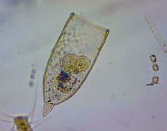 Favella