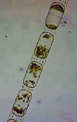 Stephanopyxis palmeriana