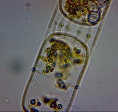 Stephanopyxis palmeriana