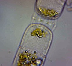 Stephanopyxis palmeriana