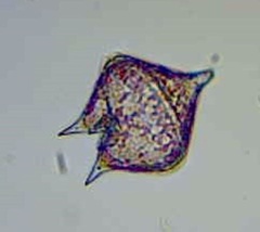 Protoperidinium