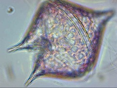 Protoperidinium