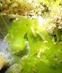 Caecum
