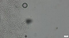Physalacria
