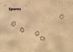 Inocybe margaritispora