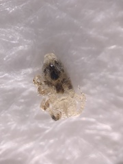 Ornithonyssus sylviarum