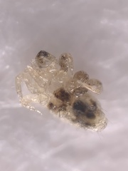 Ornithonyssus sylviarum