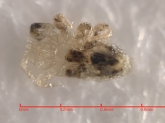 Ornithonyssus sylviarum