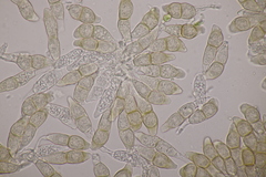 Puccinia circaeae