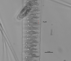 Fragilaria